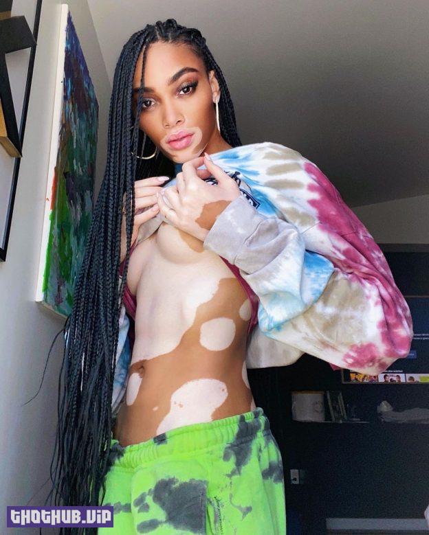 Winnie Harlow Sexy After Two Quarantine Month